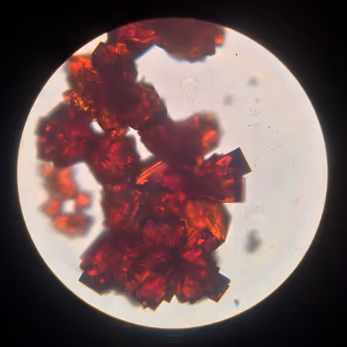 Reaction Painting Microscopy