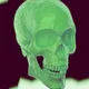Skeleton Squad