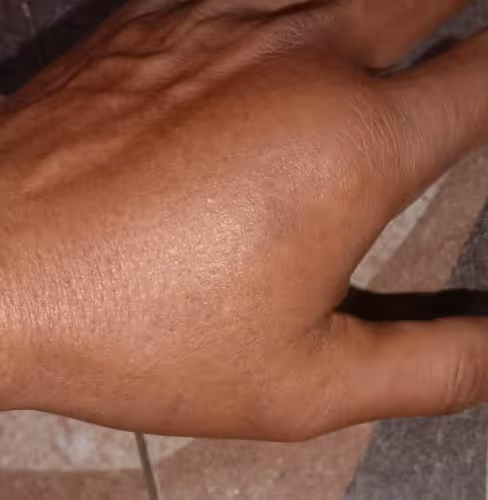 Marcador de posición de elemento multimedia