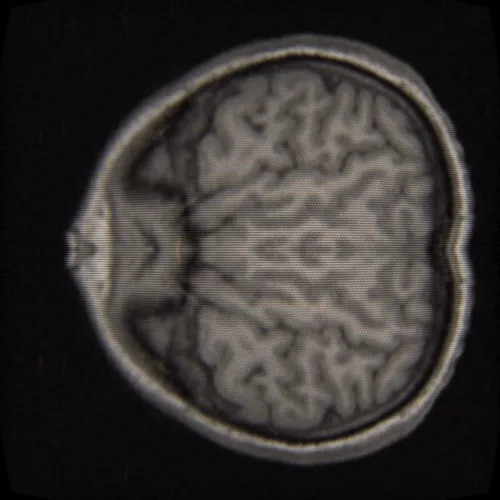 Study of a mixed reality