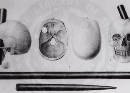 TestCollection - f7UlAqnnKy