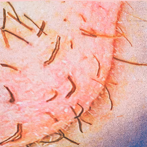 The Creation of Prickly Hair - old