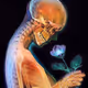 The Bone Zone