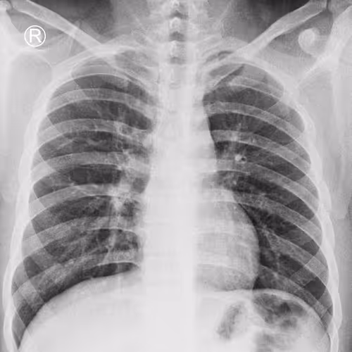 Thorax Imagin