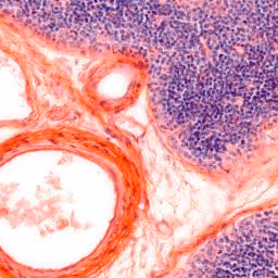 Thymus (Bries), Human, HB, 40x - old