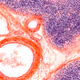 Thymus (Bries), Human, HB, 40x - old