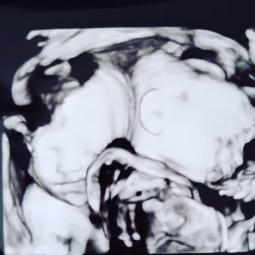 MCMA Rainbow Twins - Our unique birth