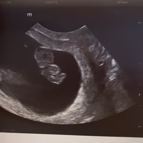 Crypto Batman baby