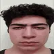 Bruh Moment Sheeesh