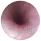Medical videos