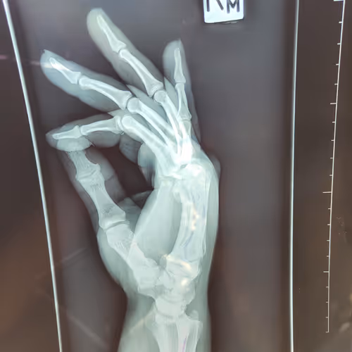 WaffleWhere - gGawTtPYEE