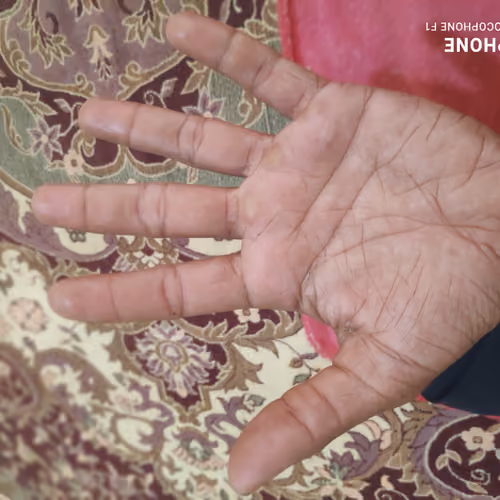Worker Hands