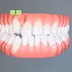 my teeth #1