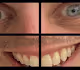 The Virus Has Spread