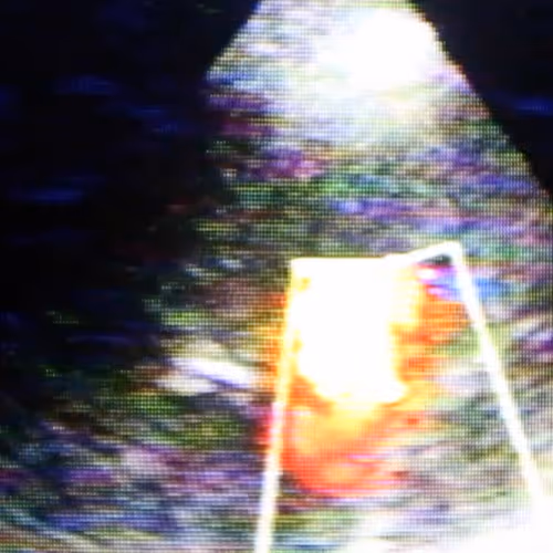 Under Seize Test by Ribal Hosn