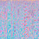 991