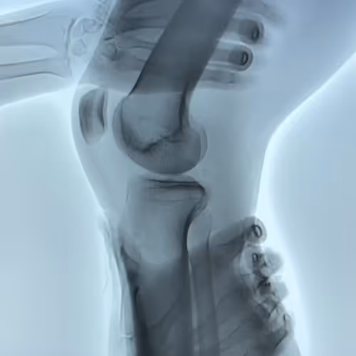 Radiological anatomy