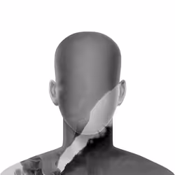 857