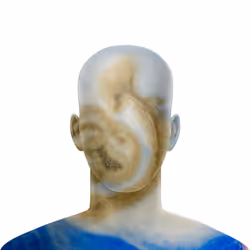 851