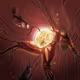 Choen V2