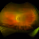 Sight