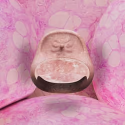 #29-Pink Adipose