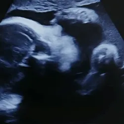 BEEBLE BABY #20