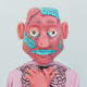 155
