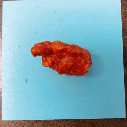 Cheeky Cheetos