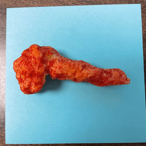 Cheeky Cheeto #8