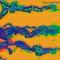 Hyphae