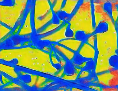 Hyphae