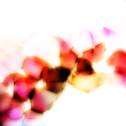 Fissures