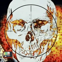 Anomaly #2640