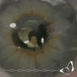 Anomaly #2879