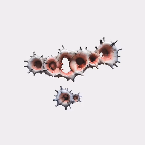 Wound Sculptures
