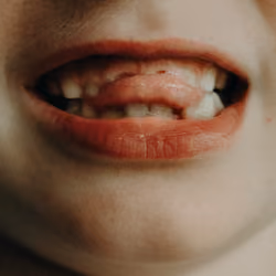 Ellipsis 92