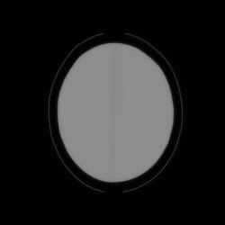65
