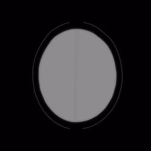 65