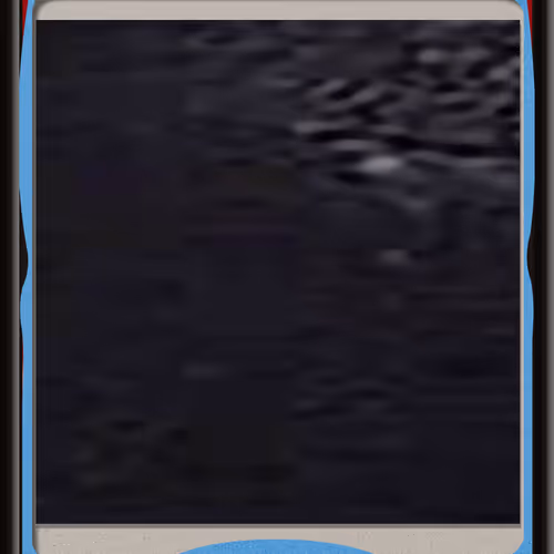 237