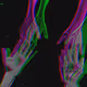 18
