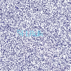 Captcha #7293