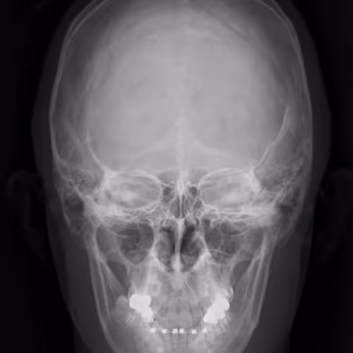 0x45a68785817a63bdc6a1d71451f41b8a4330faee