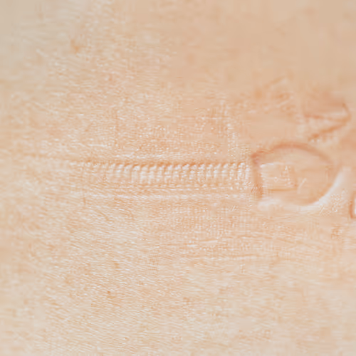 Closer - Zipper mark, 1999