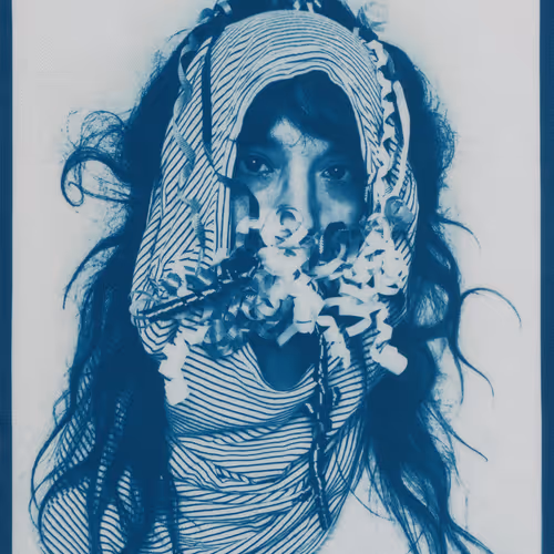 Anxious Pleasures By Amy Elkins