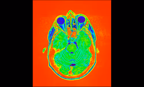 Item #64162533542198579898252916190583583845604629893829087458582976148213761835009 Media