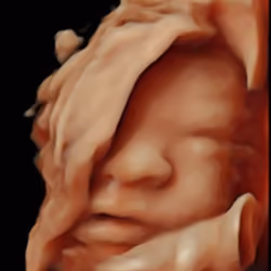 Life Starts in the womb #1