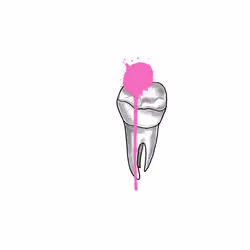 crying tooth