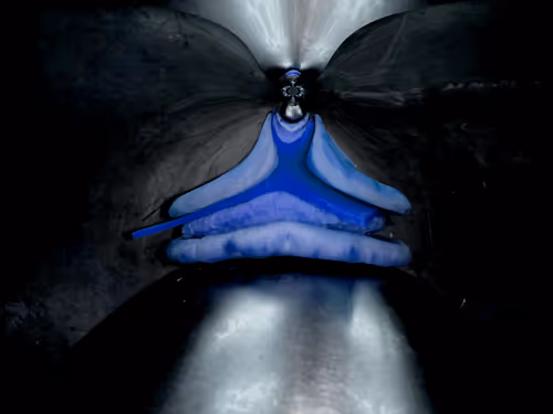 Item #67457553150443021914092587022250176347061355639032054621716076049826607792129 Media