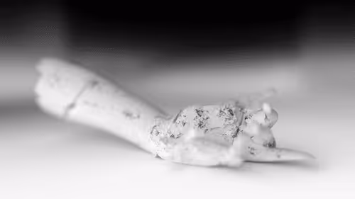Xparticles